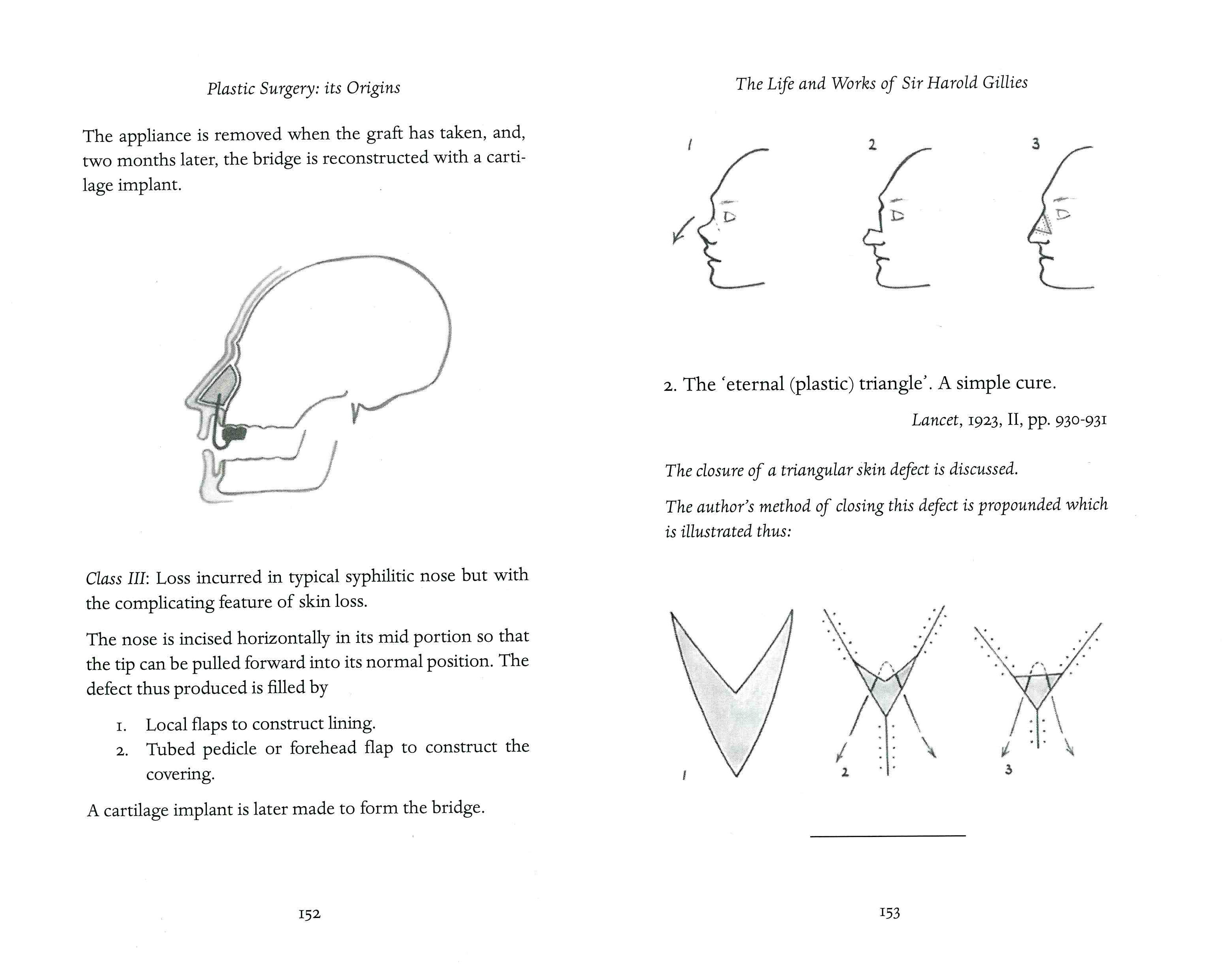 history of plastic surgery